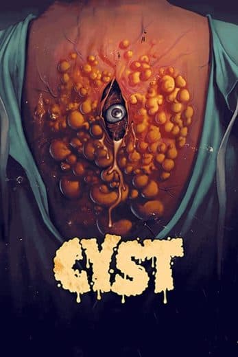 Cyst  (2021)